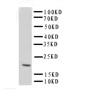 TNNC1 / Cardiac Troponin C Antibody (aa1-18)