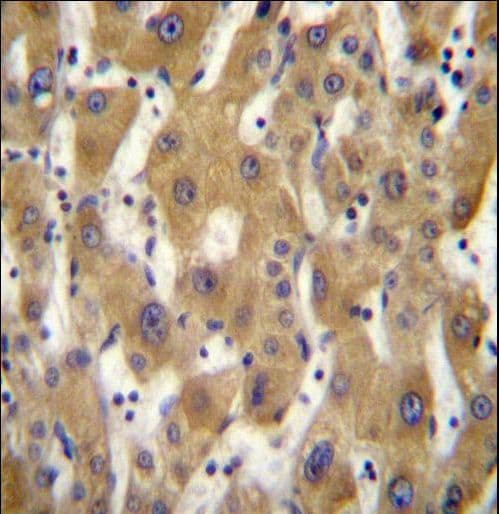 Polyclonal Rabbit anti-Human PAGE5 Antibody (aa102-130, IHC, WB)
