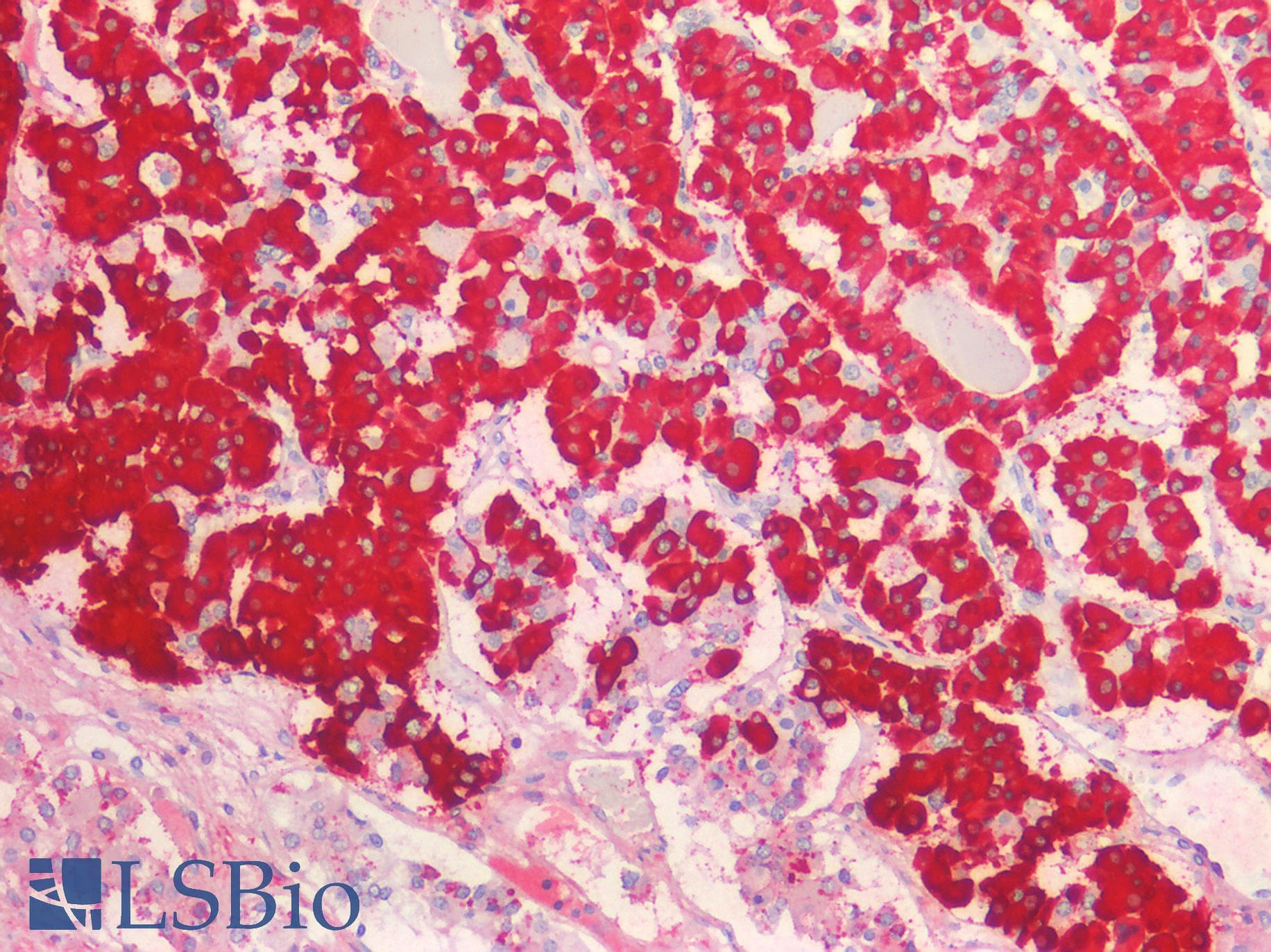 PathPlus™ GH / Growth Hormone Antibody (aa28-217)