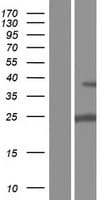 UCK1 Protein (Over-Expression Lysate Myc-DDK (Flag))