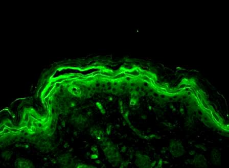 IHC-plus™ ERK1 + ERK2 Antibody