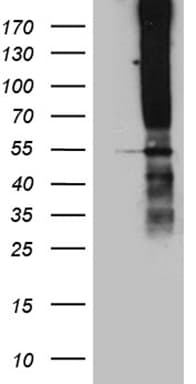 TSPAN7 / CD231 Antibody (clone OTI2D6, Carrier-free)