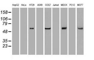 Monoclonal Mouse anti-Human KRT8 / CK8 / Cytokeratin 8 Antibody (clone OTI1B9, IF, WB)
