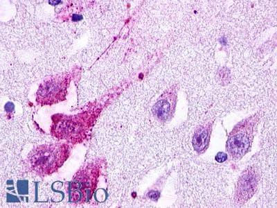 PathPlus™ Polyclonal Rabbit anti-Human GPR49 / LGR5 Antibody (Cytoplasmic Domain, IHC, IF)