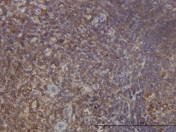 RPL9 / Ribosomal Protein L9 Antibody (clone 2F11)