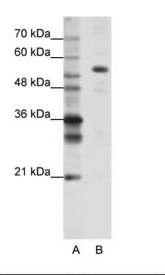 Polyclonal Rabbit anti-Human FLJ12529 / CPSF7 Antibody (C-Terminus, IHC, WB)
