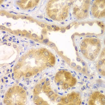 UBE1L2 / UBE1L2 Antibody