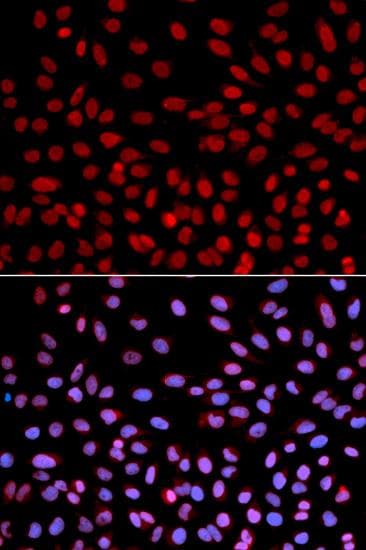 Polyclonal Rabbit anti-Human POLH / DNA Polymerase Eta Antibody (IF, WB)