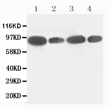 FES Antibody (aa644-663)