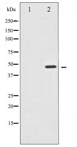 IKBKG / NEMO / IKK Gamma Antibody (phospho-Ser31)