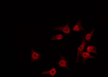 Polyclonal Rabbit anti-Human SDCCAG1 / NEMF Antibody (IF, WB)