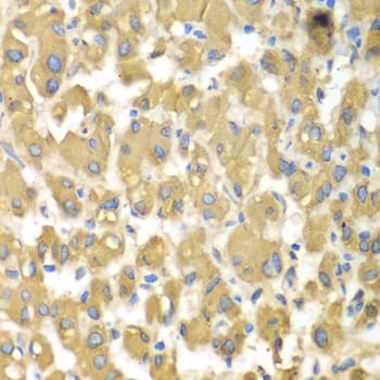 MAP4K3 / GLK Antibody (AP)