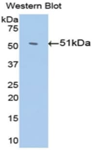 Monoclonal Mouse anti-Human Antithrombin Antibody (FITC, aa159-258, WB)