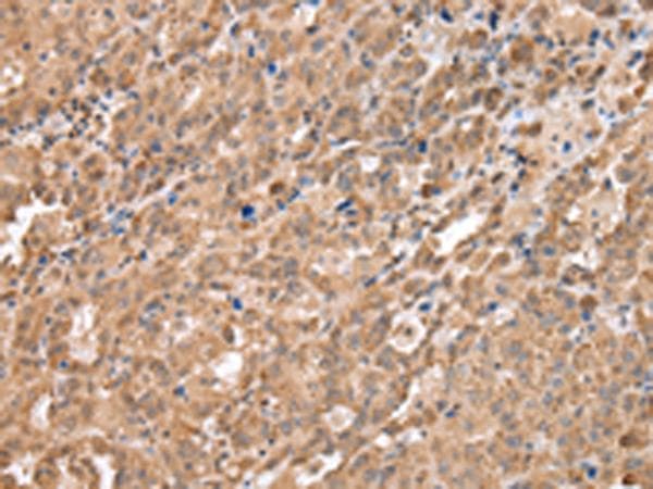 DDX58 / RIG-1 / RIG-I Antibody