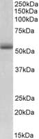 IHC-plus™ Polyclonal Goat anti-Human TRIM72 / MG53 Antibody (aa61-70, IHC, WB)