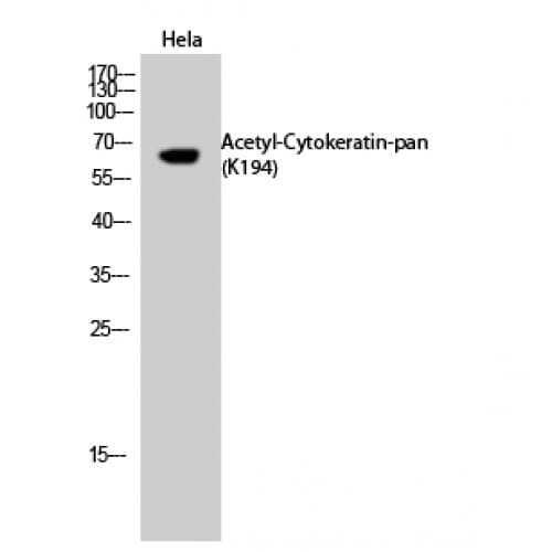 KRT2 / CK2 / Cytokeratin 2 Antibody (acetylation site of K194.)
