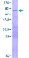 Human SHOX2 Protein (Recombinant GST)