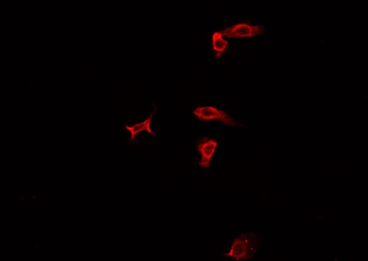 PRMT7 Antibody