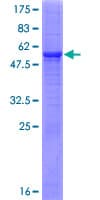 Human METTL6 Protein (Recombinant GST)