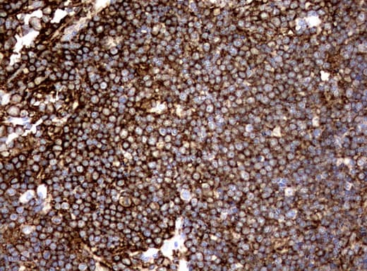 CD19 Antibody (clone UMAB103)