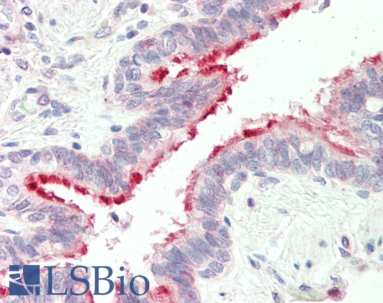 ALDH3B1 Antibody (N-Terminus)