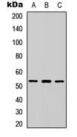 PEA3 / ETV4 Antibody (Internal)