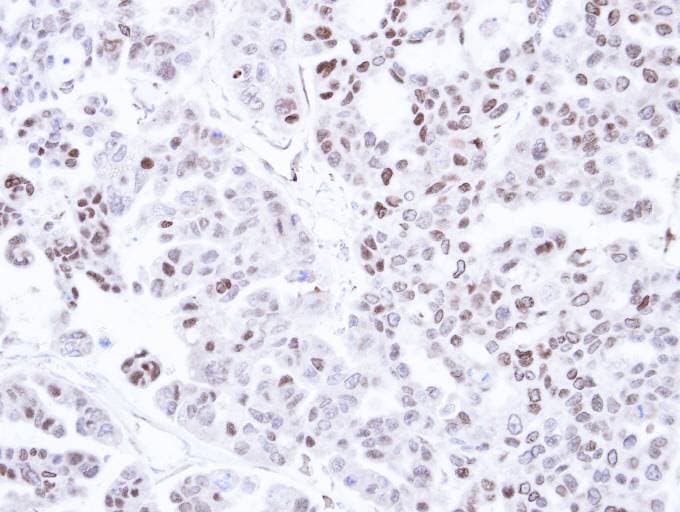 CAMK1D Antibody (aa1-385)