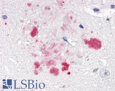 PathPlus™ Polyclonal Rabbit anti-Human NR1D1 Antibody (Internal, IHC)