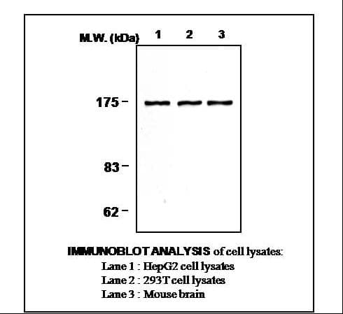 IHC-plus™ Monoclonal Mouse anti-Human PLCG1 Antibody (clone 2B1, IHC, WB)