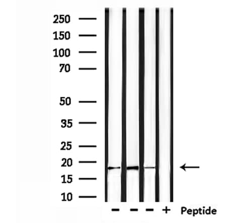 TSLP Antibody
