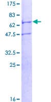 Human TRIM59 Protein (Recombinant GST)