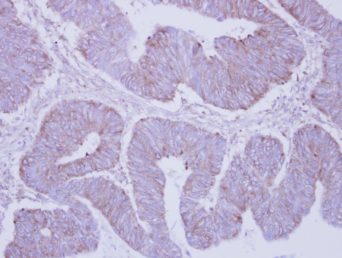 PHKA2 Antibody (aa1172-1235)