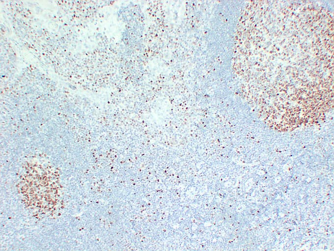 MCM2 Antibody (clone ABT-MCM2)