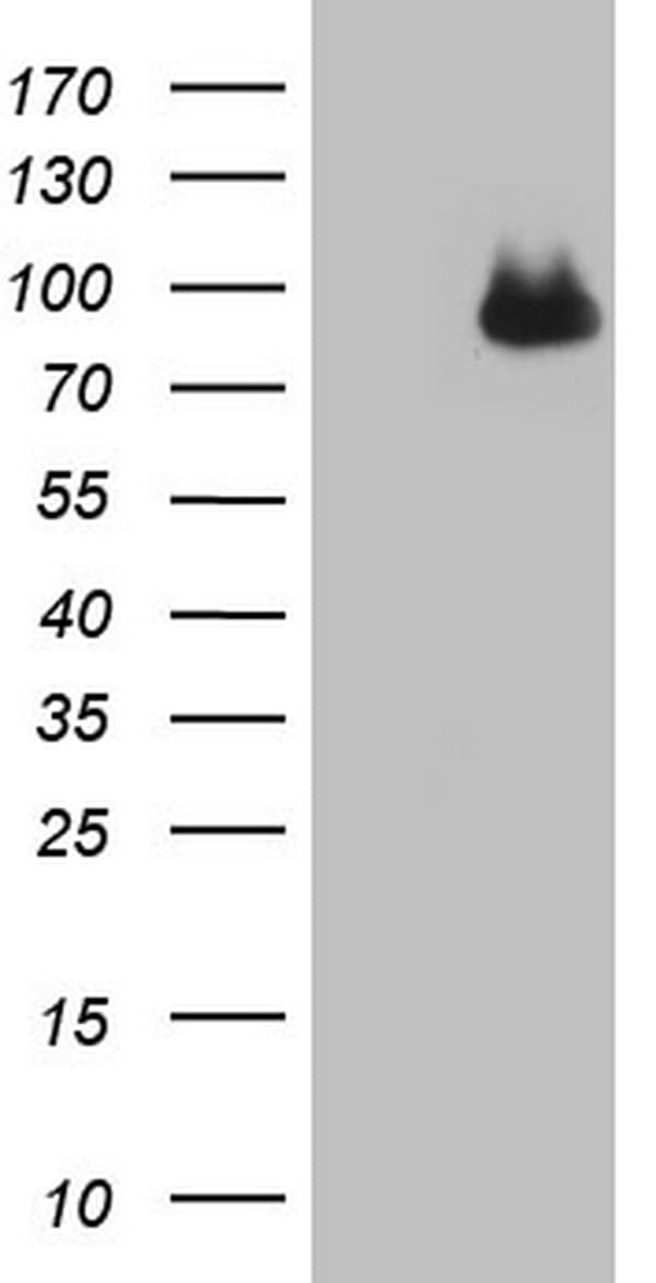 Monoclonal Mouse anti-Human CFI / Complement Factor I Antibody (clone OTI7C9, aa340-583, WB)