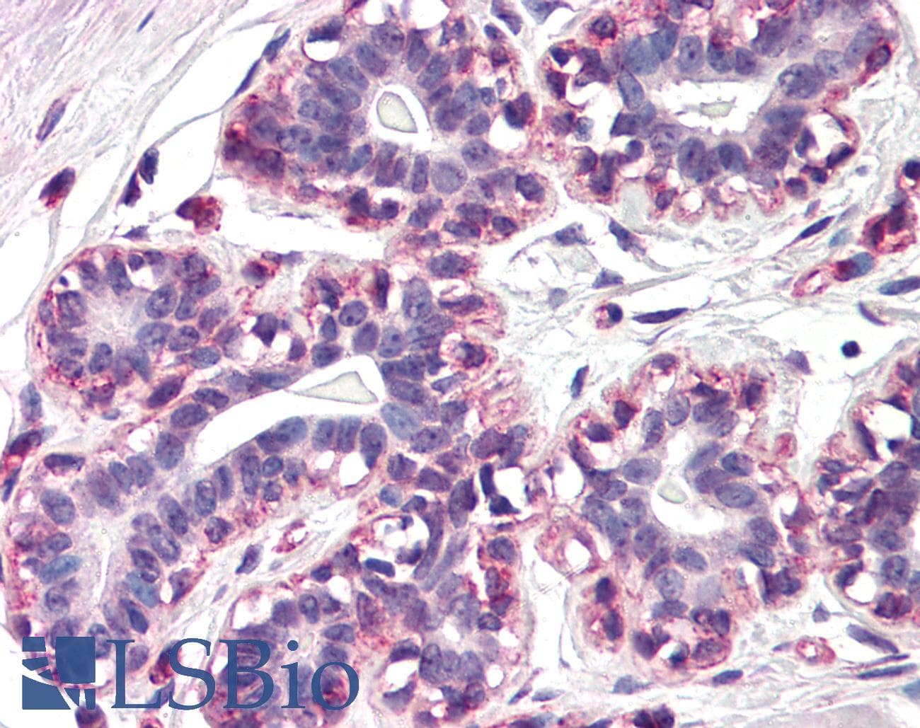 IHC-plus™ RAMP3 Antibody (N-Terminus)