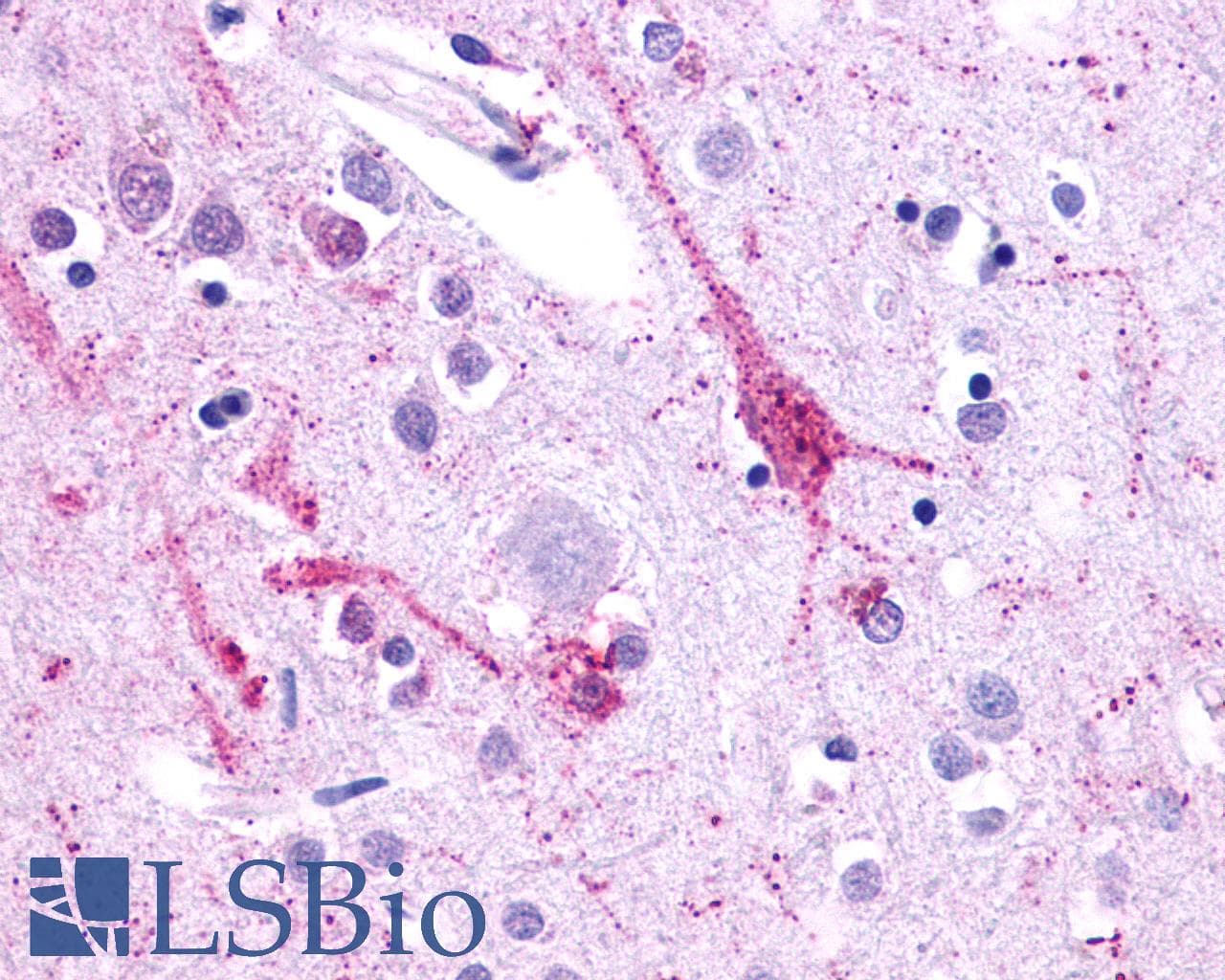 PathPlus™ CELSR2 Antibody (N-Terminus)