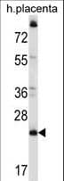 CCDC117 Antibody (aa143-171)