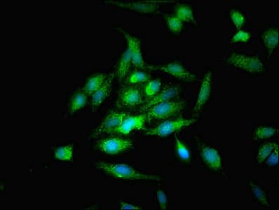 Polyclonal Rabbit anti-Human OPA3 Antibody (IHC, IF)