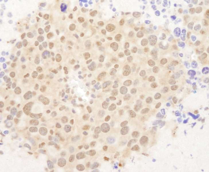 FOXO3 / FOXO3A Antibody (aa625-C-term)