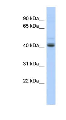 PKNOX1 / PREP1 Antibody (aa215-264)
