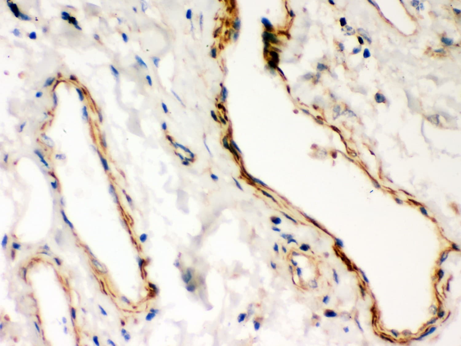 DMD / Dystrophin Antibody (aa3076-3404)
