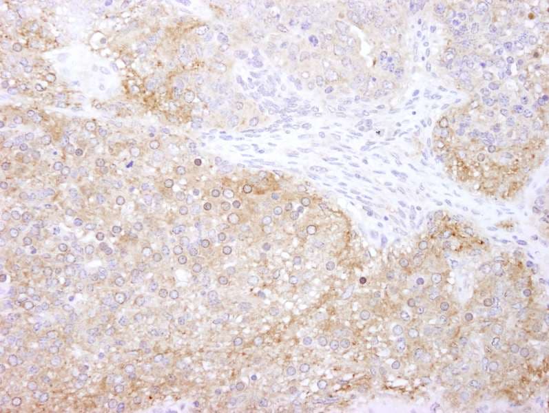 Polyclonal Rabbit anti-Human EEF2K Antibody (aa675-725, IHC, IF)