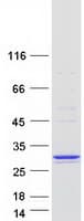 Human COMMD5 Protein (Recombinant Myc-DDK (Flag))