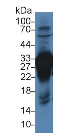 CA3 / Carbonic Anhydrase III Antibody (aa27-217, PE)