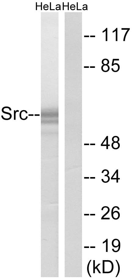 Polyclonal Rabbit anti-Human SRC Antibody (aa487-536, IHC, WB)