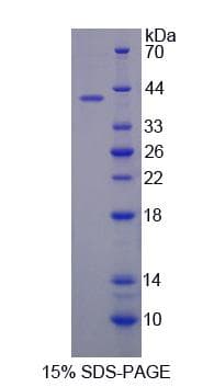 Mouse SULF2 / Sulfatase 2 Protein (Recombinant His-S)