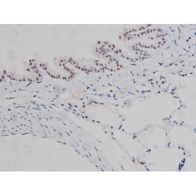 Polyclonal Rabbit anti-Human CHUK / IKKA / IKK Alpha Antibody (phospho-Ser180,phospho-Ser181, IHC, IF, WB)