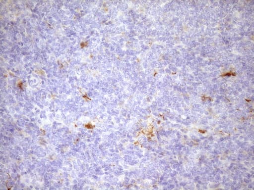 FSCN1 / Fascin Antibody (clone OTI5G1)