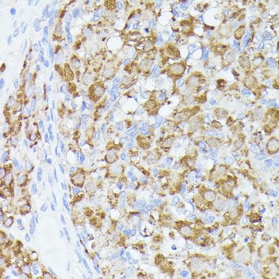 Polyclonal Rabbit anti-Human ACAT2 Antibody (IHC, IF)