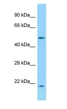 ADCYAP1R1 / PAC1 Receptor Antibody (aa325-374)